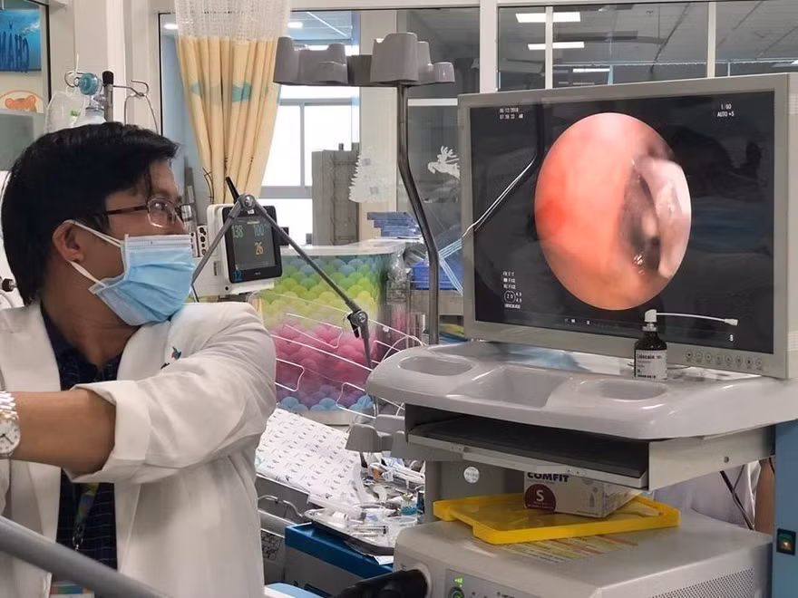 TS.BS Trịnh Hồng Nhiên đang nội soi gắp dị vật cho bệnh nhi (ảnh: BVCC)