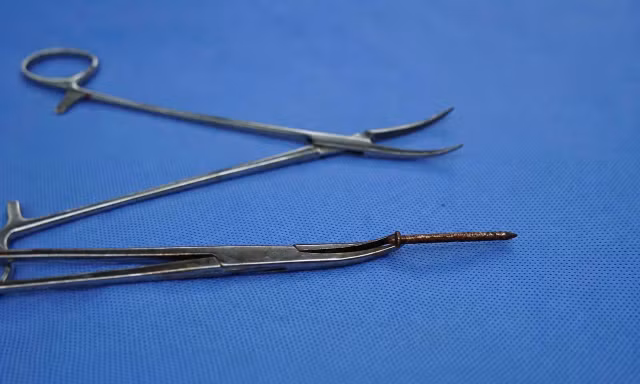 Cứu bệnh nhân bị đinh dài 4cm ghim thẳng vào bụng