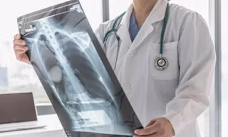 Ung thư phổi không còn là án tử: Vũ khí từ liệu pháp trúng đích và cá thể hóa