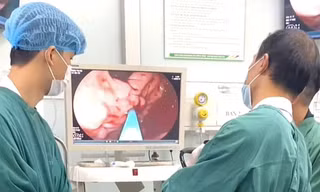 Xuất huyết tiêu hóa: Biến chứng nguy hiểm có thể khởi phát đột ngột, đe dọa tính mạng
