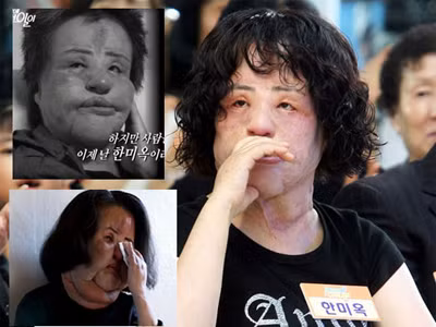 10 thảm họa dao kéo của thế giới