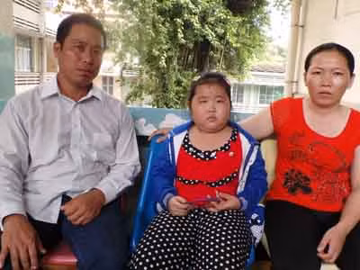 Mờ mắt sau mổ