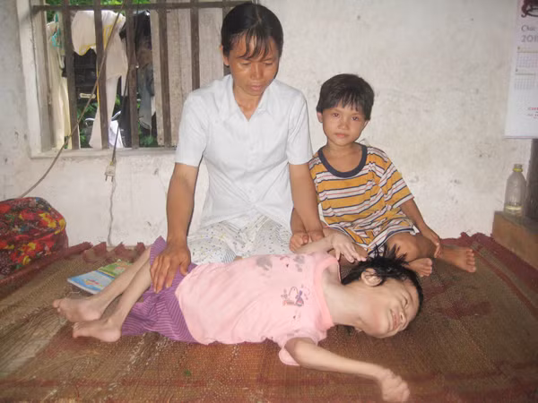 Chị Hương bên người con tật nguyền. Ảnh: D.Ng