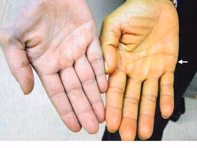 Thay đổi bất thường trên da, coi chừng bệnh nguy hiểm