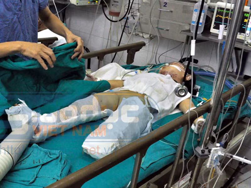 Sức khỏe cháu bé vụ nổ xe máy tiến triển tốt hơn