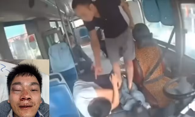 Sau va chạm giao thông, lái xe buýt ở Hà Nội bị đánh nhập viện