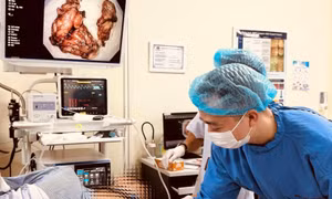 Kĩ thuật cao xử lí triệt để khối u kích thước lớn