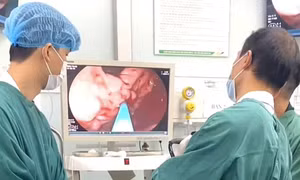 Xuất huyết tiêu hóa: Biến chứng nguy hiểm có thể khởi phát đột ngột, đe dọa tính mạng
