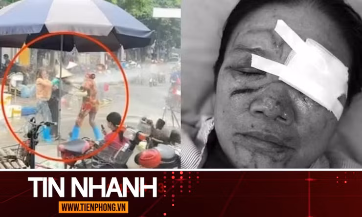 TIN NHANH: Liên tiếp xảy ra vụ xịt vòi nước cao áp vào người khác, luật sư nói gì?