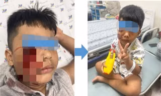 Nhiều trẻ bị thú nuôi tấn công, phải cấp cứu