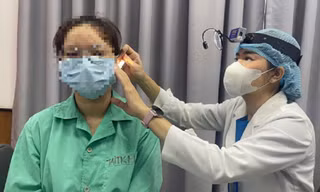 Bị vỡ xương thái dương, suýt điếc vĩnh viễn vì… ngoáy tai