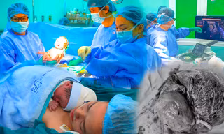 Bác sĩ 'vá' mạch máu trong bụng mẹ, cứu thai nhi mắc khối u khổng lồ