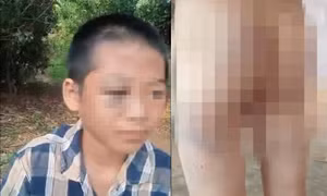 Xôn xao clip học sinh lớp 6 nghi bị người thân bạo hành