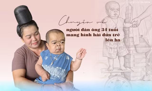 Chuyện về người đàn ông 34 tuổi mang hình hài đứa trẻ lên ba