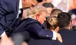 Ông Trump bị bắn vào tai phải trong cuộc vận động ngày 13/7. (Ảnh: Reuters)