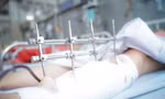 Nữ nạn nhân vụ sập tường kinh hoàng ở Long An đã thoát 'cửa tử'