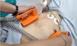 Liên tục sốc điện cứu bệnh nhân chết lâm sàng thoát cửa tử