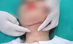 Sở Y tế TPHCM: 'Hành nghề thẩm mỹ chui luôn là vấn đề nóng'