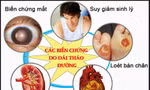 Biến chứng kép tim mạch – võng mạc ở bệnh nhân tiểu đường: Có thể ngăn chặn từ sớm