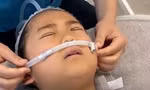 Ám ảnh sợ xấu, cô bé 9 tuổi phẫu thuật thẩm mỹ 
