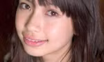 Angelababy kiện bệnh viện vì 36 bức ảnh thời chưa chỉnh răng
