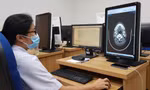 Bác sĩ Bệnh viện Ung Bướu TPHCM hội chẩn từ xa qua công nghệ thông tin ảnh: Vân Sơn 