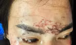 Khởi tố vụ án người phụ nữ 'tố' bị bắt giữ, đánh đập, xăm mặt vì ghen 