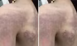 Làm rõ thông tin bé gái lớp 3 'bị giáo viên đánh bầm tím người'