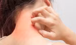 Ngứa da điên cuồng, có thể bạn đã mắc phải một trong các 'bệnh trọng' sau