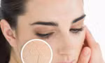 Da khô nứt nẻ mùa đông nên ăn ngay những thực phẩm này bởi giữ ẩm cực tốt