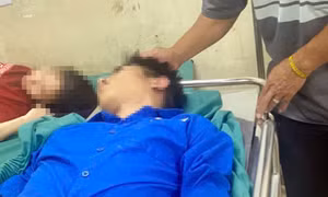 Công an vào cuộc vụ nam sinh Hải Phòng bị đánh gãy sống mũi