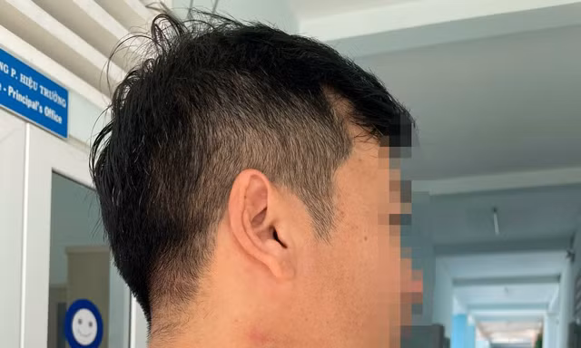 Thầy giáo bị đồng nghiệp bóp cổ giữa sân trường vì nhắc đỗ xe sai quy định