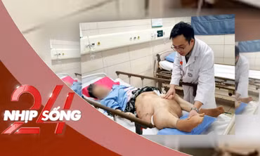 NHỊP SỐNG 24: Bỏ không điều trị khối u, người phụ nữ liệt hoàn toàn, biến dạng nhiều bộ phận cơ thể