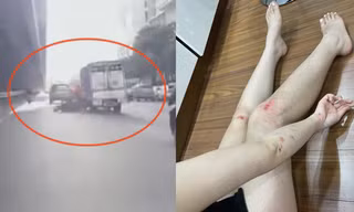 Cô gái Hà Nội kể phút bị xe tải đe dọa 'mày tin tao đâm không' rồi húc ngã