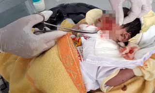 Cháu bé được các bác sĩ cấp cứu hô hấp, rửa vết thương trên mặt. Ảnh: Người Lao Động