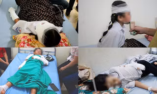 Nguyên nhân bất ngờ vụ bóng bay phát nổ trong ngày khai giảng khiến 10 học sinh bị bỏng
