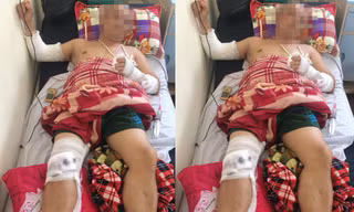 Anh Yên bị chém gục tại quán ăn đang được điều trị tại bệnh viện