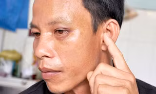 Anh Hồng bị thủng nhĩ tai trái, bầm mắt
