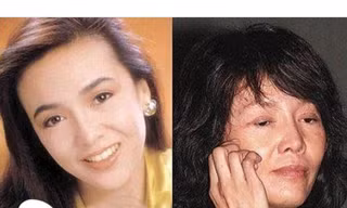 Một cô gái trở thành bà già sau ca giải phẫu thẩm mỹ