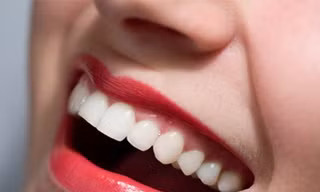 Bí mật giúp bạn có hàm răng trắng bóng hơn