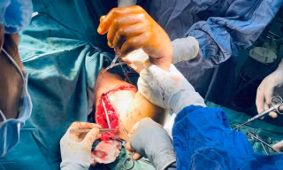 Nối thành công cánh tay bị đứt lìa