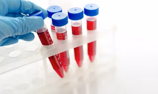 Nghi phạm dùng vật nhọn khiến 10 người phơi nhiễm HIV khai gì?