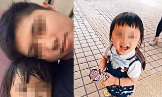 Bé 5 tuổi bị mẹ kế hành hạ khiến cơ thể kiệt quệ như người già làm cộng đồng mạng phẫn nộ