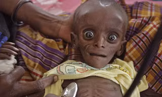 Nạn đói hoành hành ở Somalia