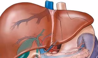 Vài điều nên biết về xơ gan