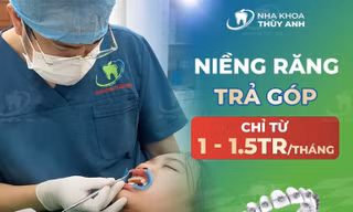 Niềng răng trả góp chất lượng cao tại nha khoa Thùy Anh 