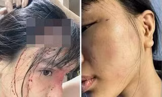 Hình ảnh thương tích của nạn nhân.