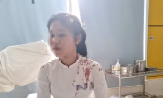 Nguyên nhân ban đầu vụ nữ sinh dùng guốc đánh bạn cùng lớp chảy máu đầu