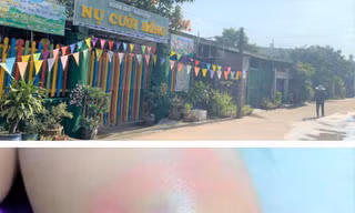 Bé gái 4 tuổi nghi bị cô giáo đánh bầm tím vì đi vệ sinh trong quần