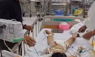 Xác định nguyên nhân bé 7 tuổi tử vong sau khi tháo đinh nẹp tay